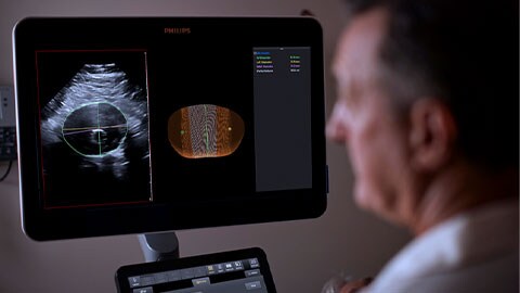Abdominal aortic aneurysm surveillance with 3D ultrasound