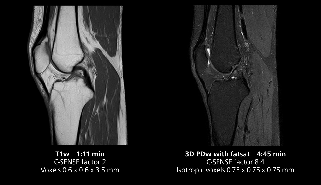 Knee mri one