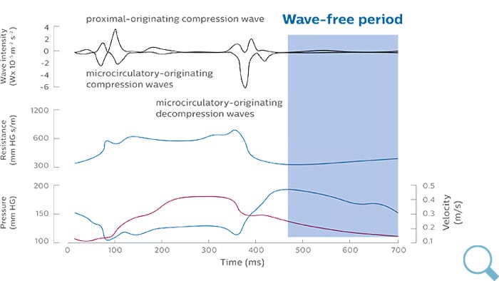 iFR wave-free period download image