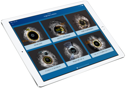 IVUS expert ipad