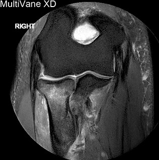 mri multivane comparison 2