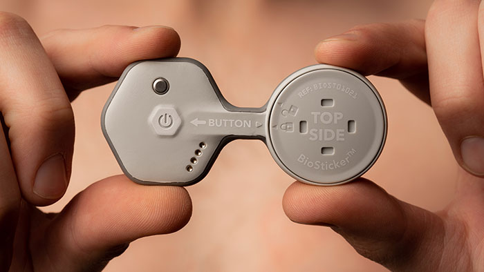 Improved remote patient monitoring