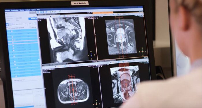 MRI in the radiotherapy workflow